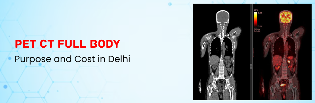  PET CT Full Body: Purpose and Cost in Delhi